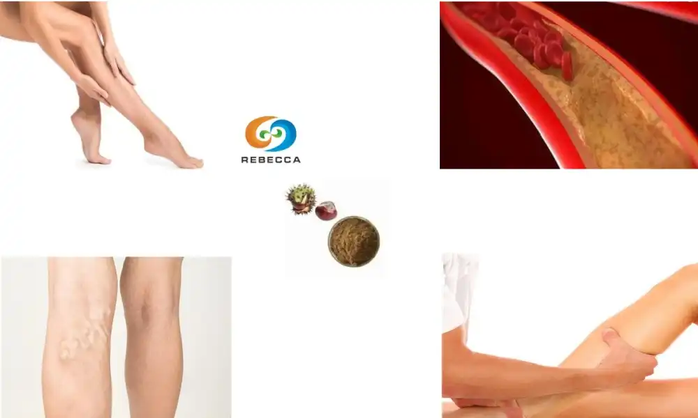 Horse Chestnut Seed Extract Powder: A Natural Remedy for Varicose Veins Horse Chestnut Seed Extract Powder: A Natural Remedy for Varicose Veins